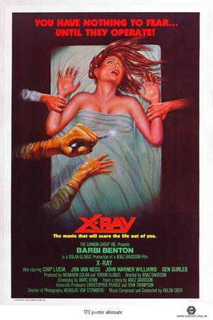 X-Ray poster